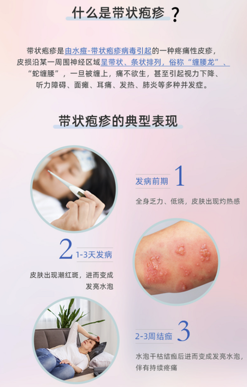 全国带状疱疹疫苗生蛇2次接种预约