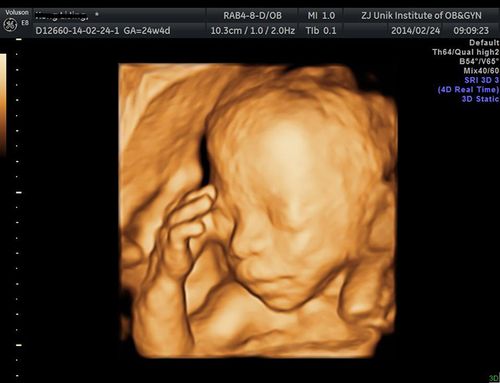 高级三维四维彩超套餐