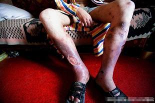 吸毒者的堕落生活实录(组图)