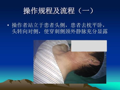 2011年 颈外静脉穿刺留置ppt