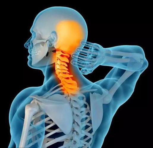 颈椎病可分几种类型?专家告诉你答案,看完记得要注意了!