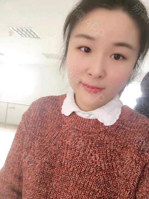 新氧- 氧气583ad11ebb8a524 | 大连同城 | 新氧女孩
