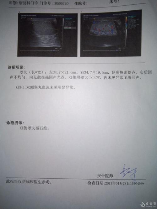 彩超双侧睾丸微石症会不孕不育吗?