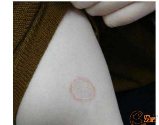 你真的认清猫癣了吗?|轻度猫癣其实可以不用治疗!