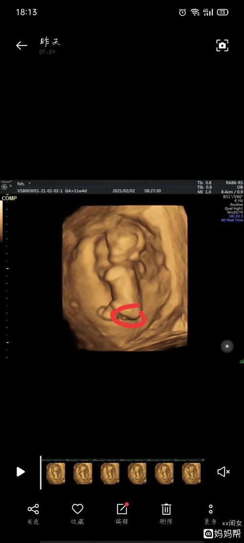 附一张nt数据有会看男女的嘛头胎男女