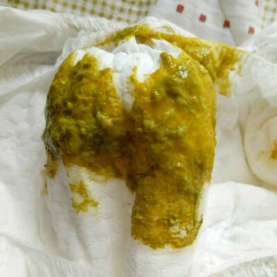 宝宝这几天拉肚子 吃了药也不见好转能不能吃 这是消化不好吗 上吗是