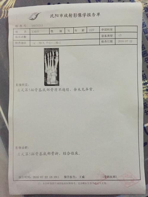 我想知道我这个脚可以评工伤的伤残等级鉴定吗?