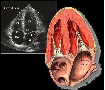胸骨旁左室长轴切面 解剖图 解剖图  胸骨旁主动脉根部短轴切面 解剖