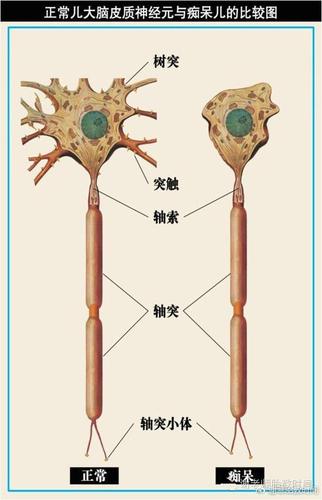 胎宝宝的大脑智能如何被胎教影响?|脑细胞|神经元