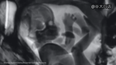 mri下诡异而奇妙的人体|核磁共振|猎奇|搞笑_新浪新闻