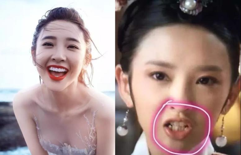 盘点装了烤瓷牙的明星又大又白的牙真的适合每一个人么