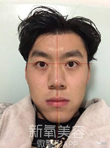 因为同学两只眼睛差别有点明显,所以用了耳朵做横向的线,实际的下巴