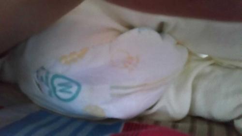 各位男宝妈观察一下,宝宝平躺时尿液会