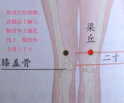 急性胃痛求"梁丘"