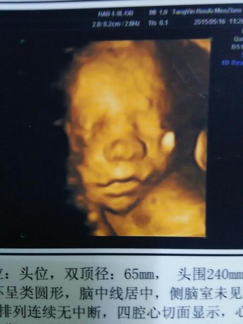 这是六个月拍的四维彩超,我的儿子,长的和我老公很像,现在我真的好