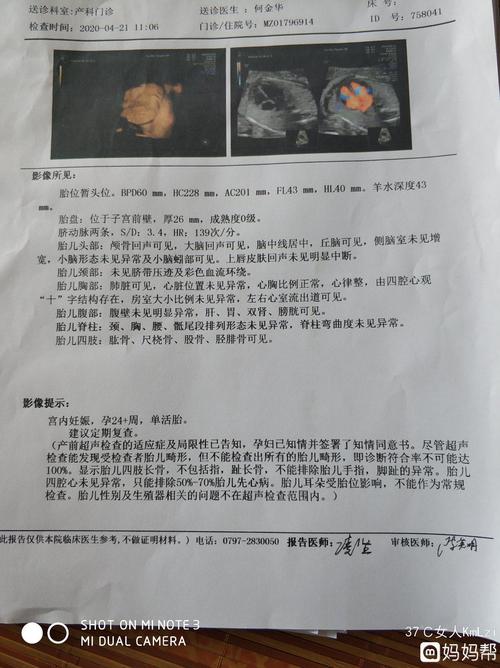 各位宝妈们帮忙看一下胎盘成熟度为0是什