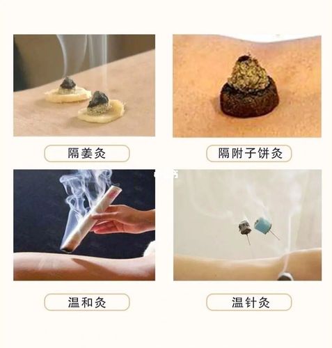 三伏灸_中医_医疗健康_医疗方法