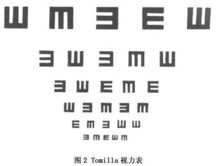 弱视眼的拥挤现象