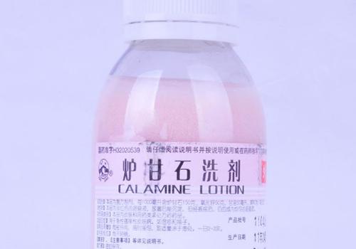怎么用炉甘石治荨麻疹                   4           1,在使用