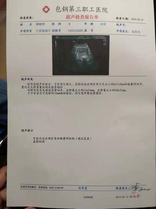 有没有45天拍彩超是宫角妊娠的9月12号拍阴超是宫角妊娠