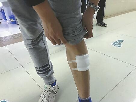 为护幼女男子腿被咬伤 事发广场禁止遛狗