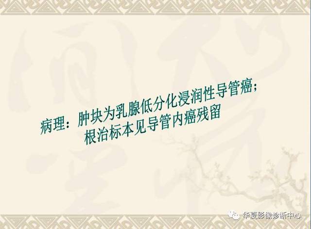 乳腺导管原位癌的mri诊断!