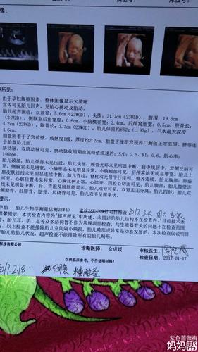 今天四维顺利通过,大家帮我看(⊙o⊙)看男宝女宝