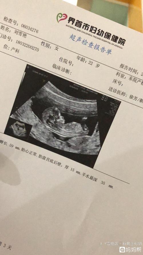 12周3天拍的b超,医生说看不清男孩女孩,好像是个女孩.