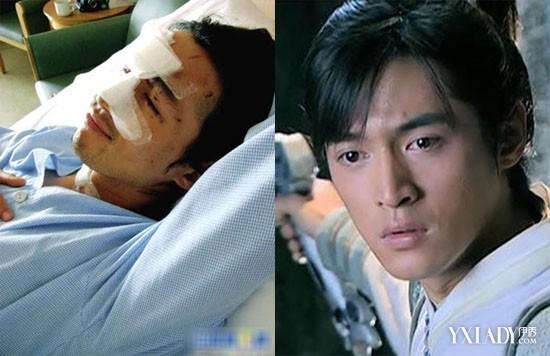 【组图】胡歌车祸毁容照片曝光 胡歌整容前后照片萌神