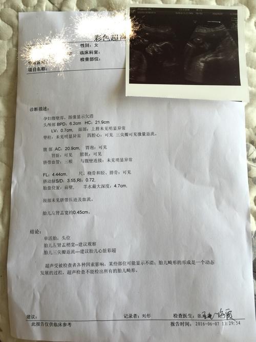 胎儿三尖瓣可见微量反流是什么情况,严重不