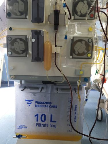 商丘市第一人民医院icu成功开展首例血浆置换治疗新技术