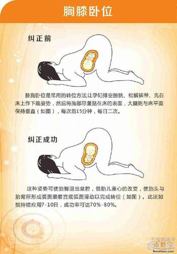 多跟宝宝沟通一下看看能不能转过来,也可以做胸膝卧位