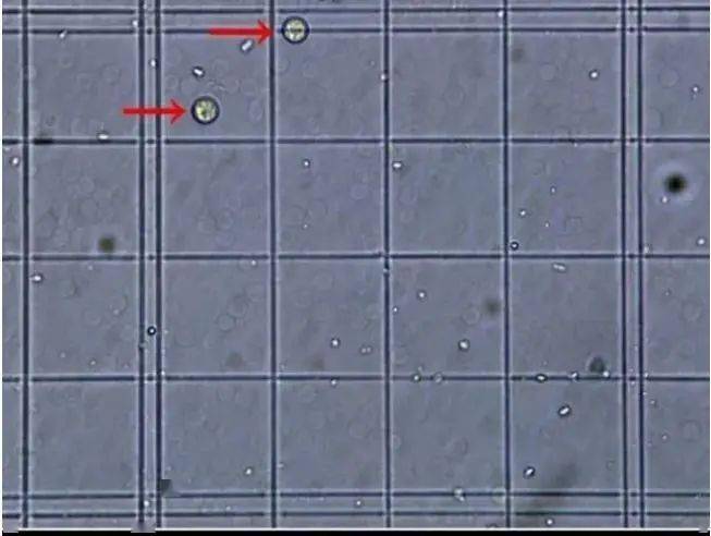 重温血小板手工计数法