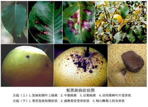 阿克苏地区温宿县黑斑病阿克苏地区温宿县红斑狼疮早期症状