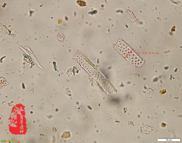 钩藤具缘纹孔导管