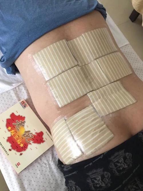 老倪膏药各部位贴敷方法