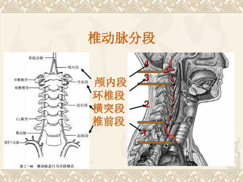 什么是椎动脉型颈椎病艾灸治疗椎动脉型颈椎病