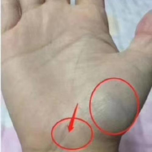 如果大鱼际发青,那么您就要注意了 正常情况下大鱼际的皮肤是红润的