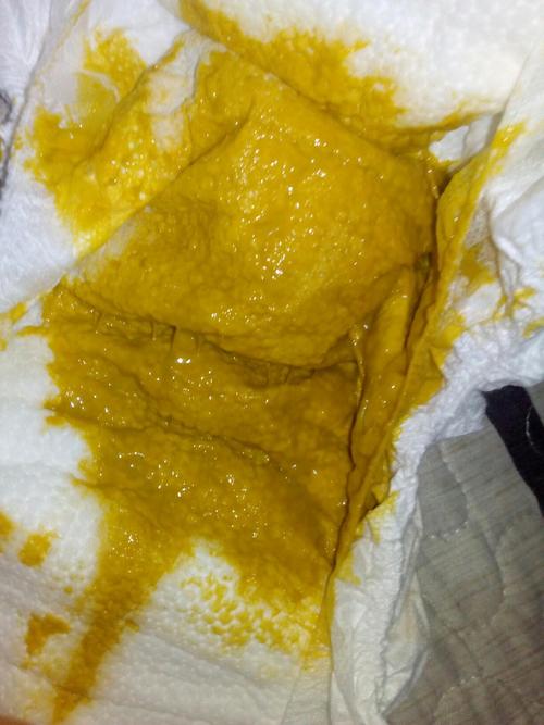 宝宝三个月9天,目前纯母乳喂养,一天拉1-2次,这样的便便正常吗?