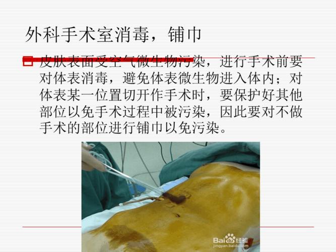 手术皮肤消毒铺巾及穿针引线方法.ppt