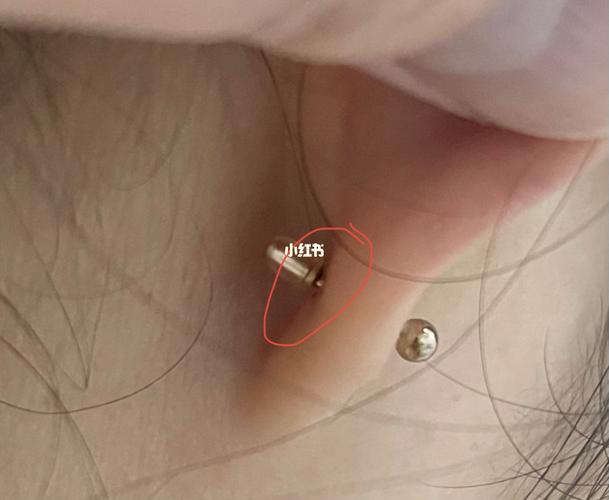 穿耳洞第21天 还是化脓了_耳洞_发炎_百多邦怎么样_耳环_微信_耳钉