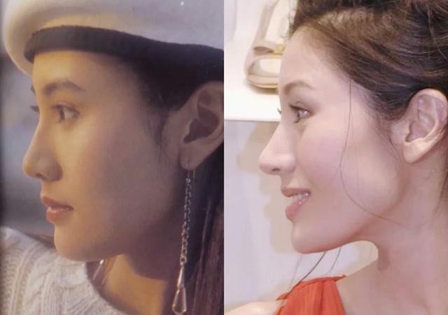 苏王李嘉欣鼻子美颜分析