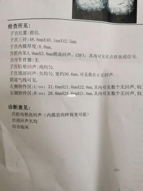 子宫内膜息肉_子宫_妇科炎症_中药_月经_中医_医疗健康_医疗健康其他