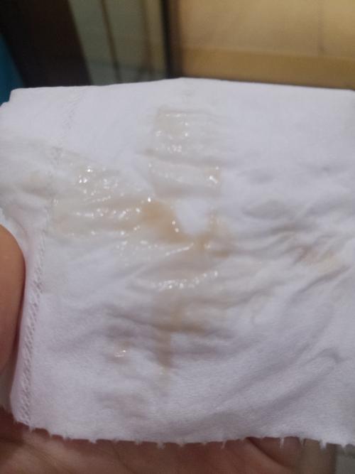 宝妈们,这个分泌物颜色是先兆流产症状吗?