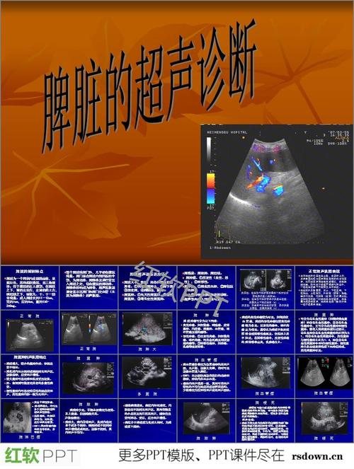 脾长径:在左肋间斜断面显示脾最长径线,         测量其上下端的