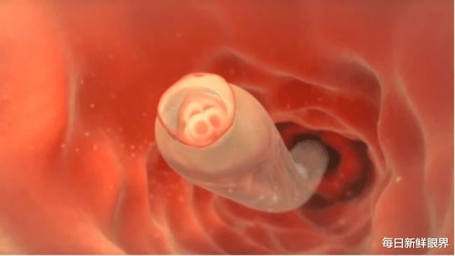 但是和男性有着很大的关联,所以说关爱子宫不只是女人的责任,你觉得