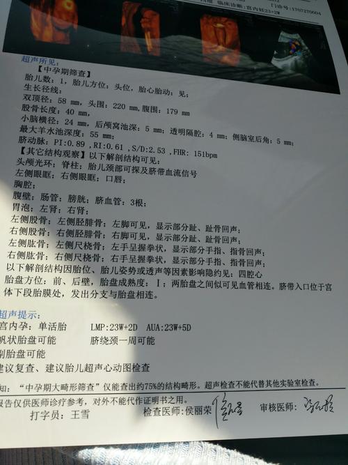 两胎盘之间似可见血管相连,脐带入口位于宫体下段胎膜处,发出分支与
