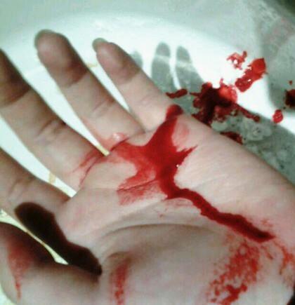 男孩子手受伤过图片骗女朋友