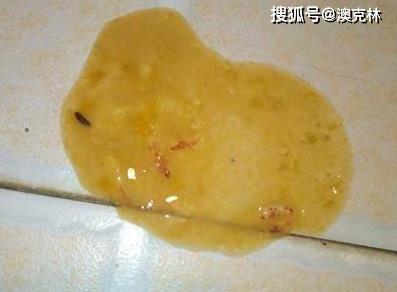 病犬初期精神沉郁,厌食,呕吐,初期呕吐物为食物,呈黏液状,黄绿色,有时