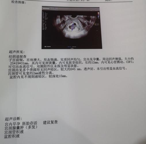 [试管婴儿]移植第35天,孕囊大小也都跟上